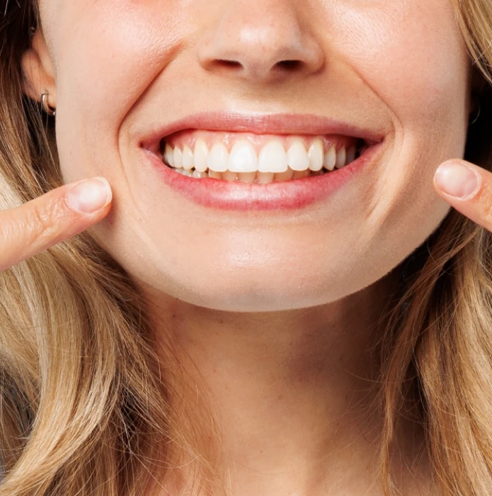 ESTETINIS PLOMBAVIMAS – NUO 159 €