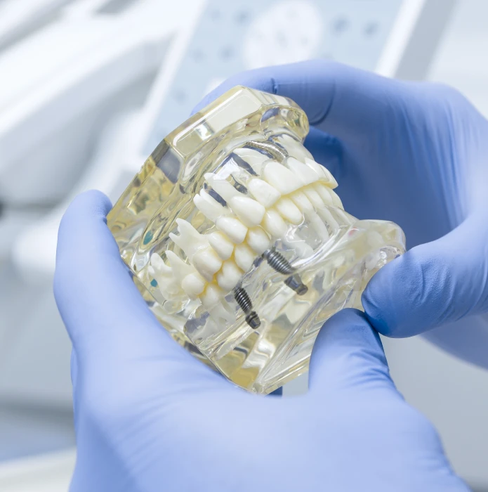 JD ICON IMPLANTAS SU ĮSRIEGIMU – 499 €